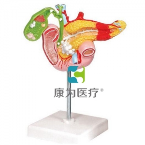 “康为医疗”病理模型胰腺模型，十二指肠和胆囊模型