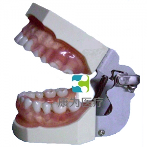 “康为医疗”牙龈病模型