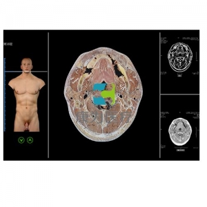 断层解剖与断层影像虚拟教学系统