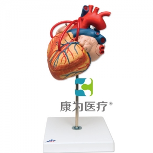心脏搭桥的心脏模型，实物的 2倍，4部分