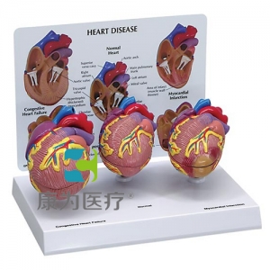 “康为医疗”医患关系沟通模型-正常心脏解剖模型 （医学指导模型）